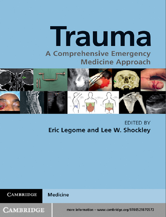 Trauma: A Comprehensive Emergency Medicine Approach