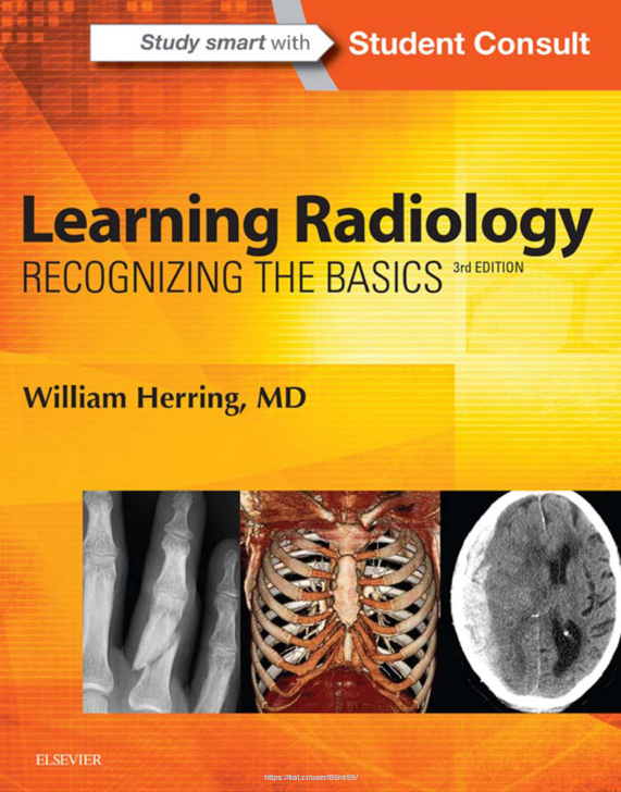 Learning Radiology : RECOGNIZING THE BASICS